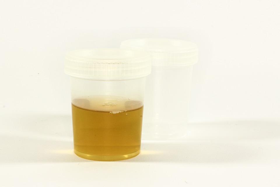 is-urine-sterile-and-other-questions-about-using-pee-in-first-aid